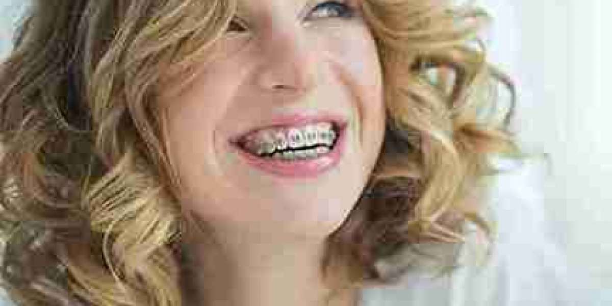 Bringing Clarity to Common Smile Issues in Reading