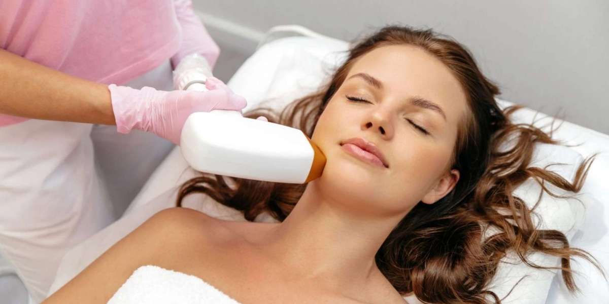 Laser Hair Removal for Dark Hair: Techniques That Work Best