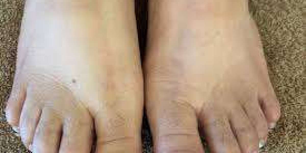How Often Should You Get Pedicures? The Ultimate Guide to Healthy Feet