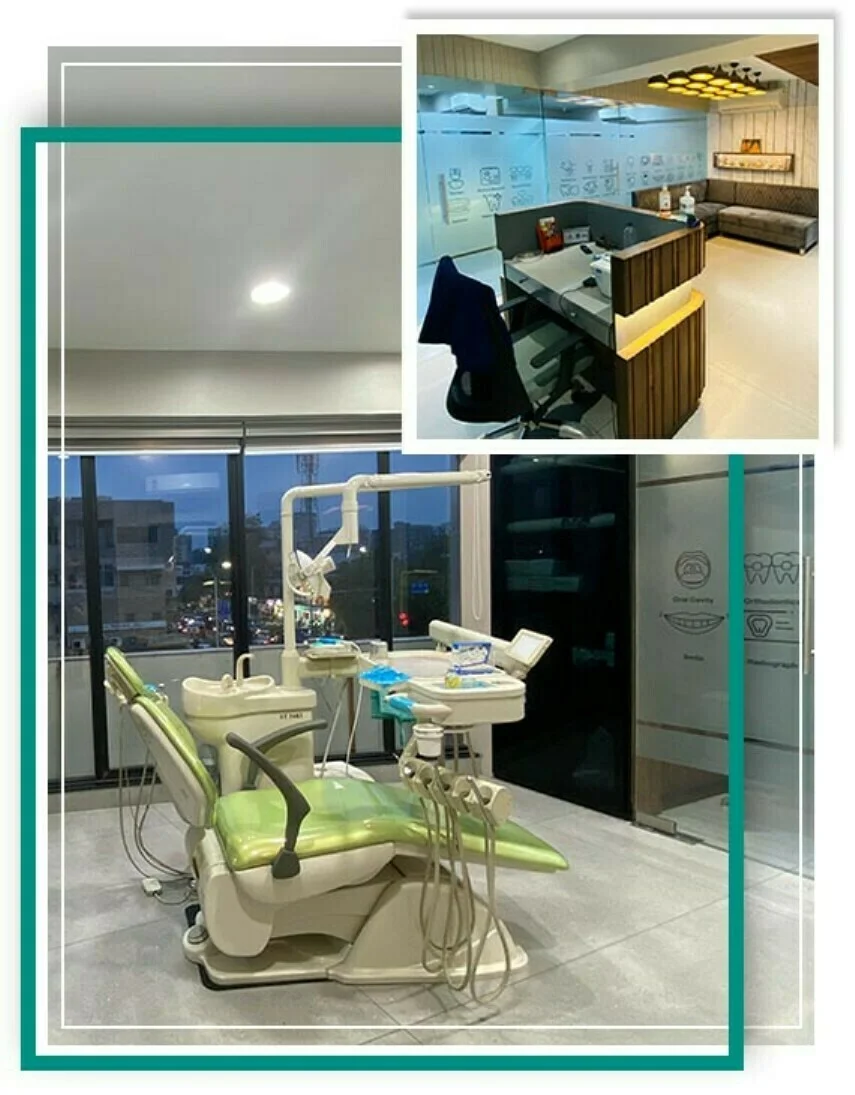 Types of Dental Braces: Find Your Best Option in Ahmedabad