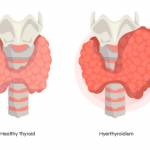 duoprime medicalcenter