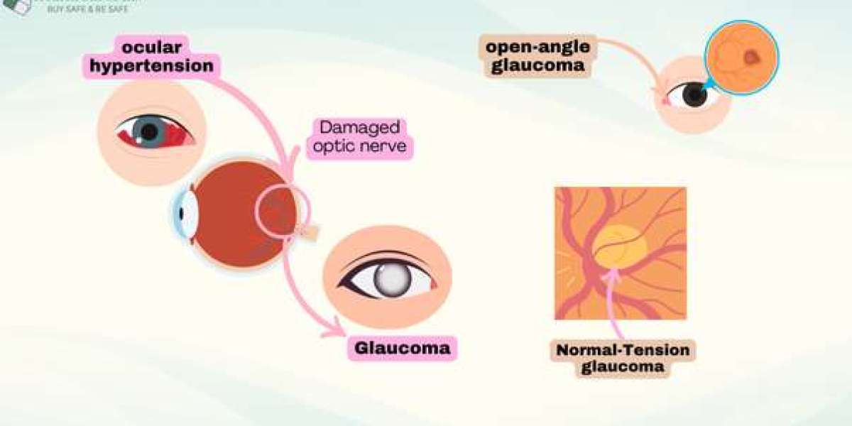 Is it fine to apply Latisse Lumigan 0.01% once a Day?