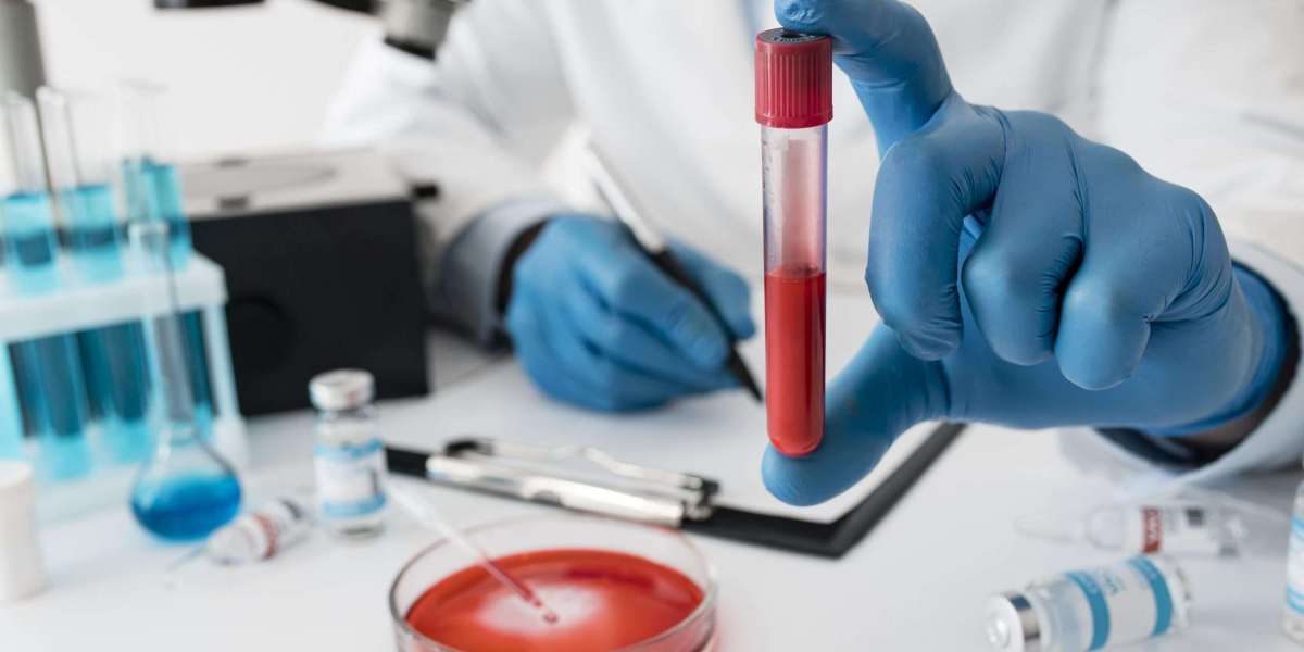Best Blood Test at Home in Bangalore – Affordable, Accurate & Convenient Diagnostic Care