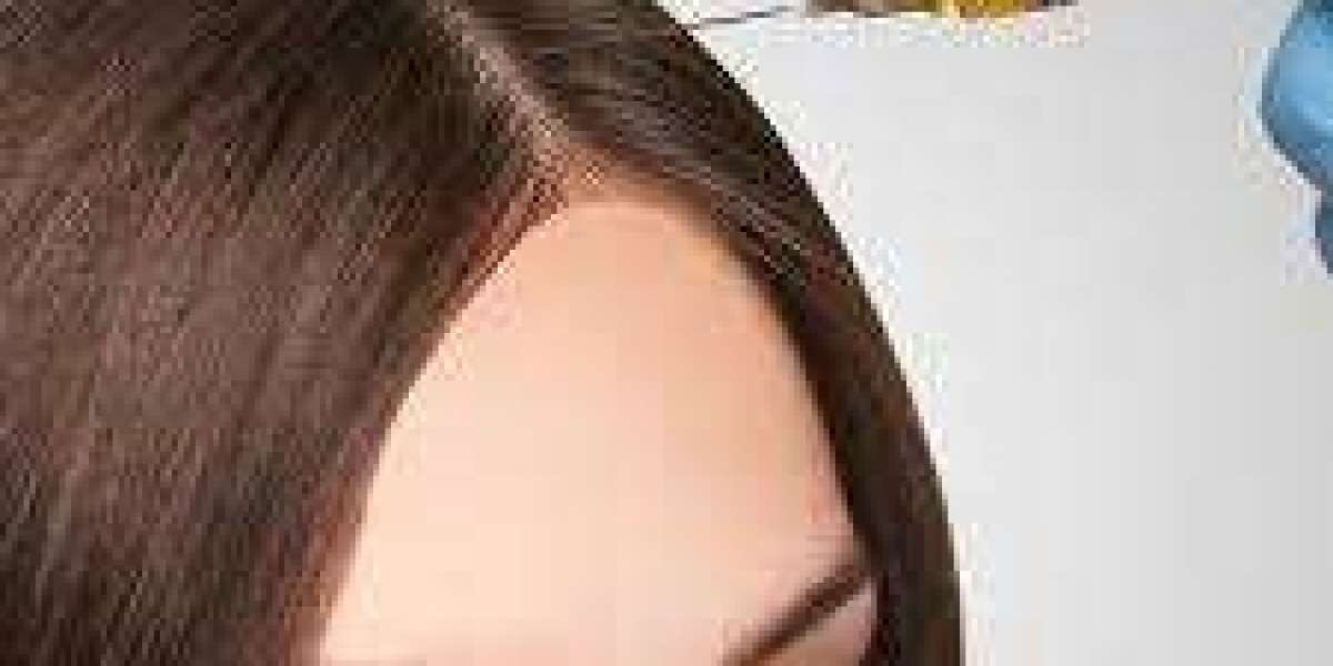 Is PRP hair treatment in Dubai effective for postpartum hair loss?