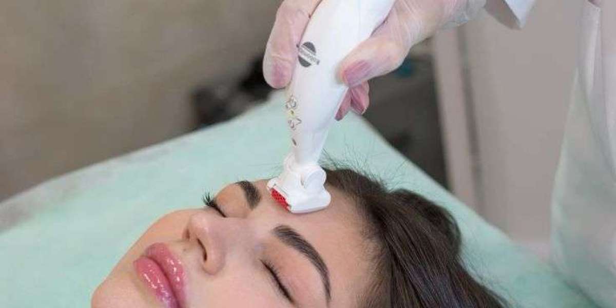 Reclaim Youthful Radiance with Morpheus8 Treatment in Riyadh