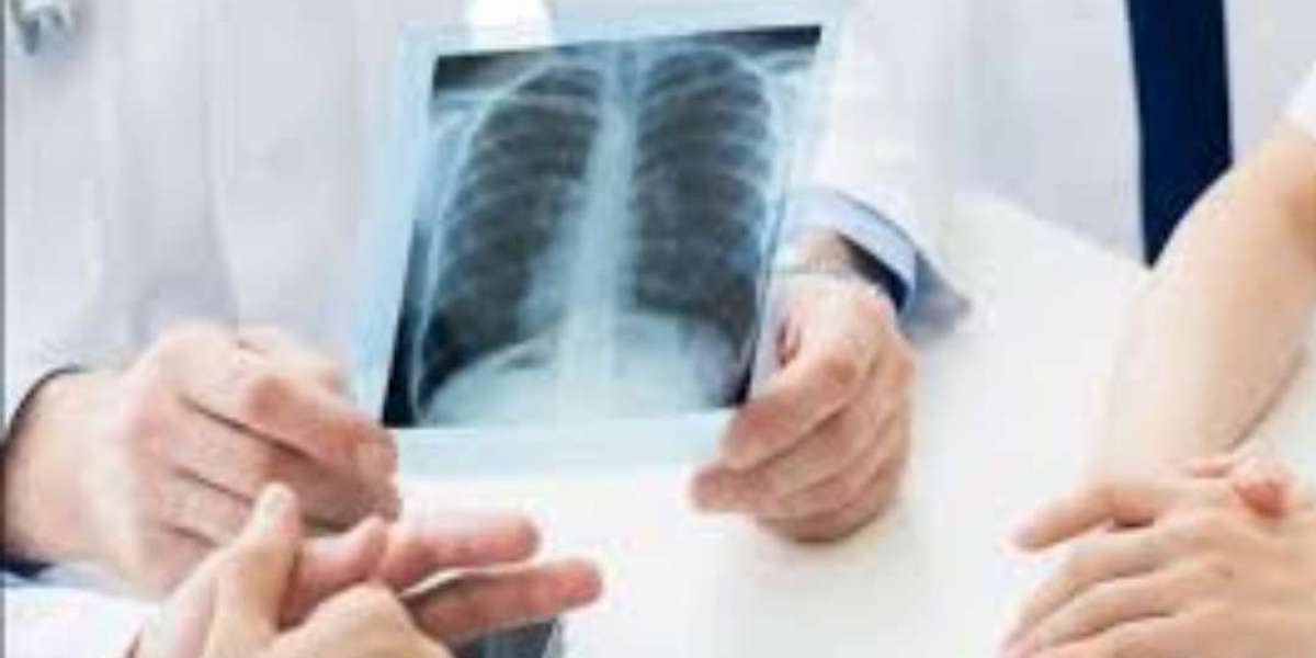 Best X Ray Lab Near Me | Advanced Digital Imaging & Accurate Diagnostics