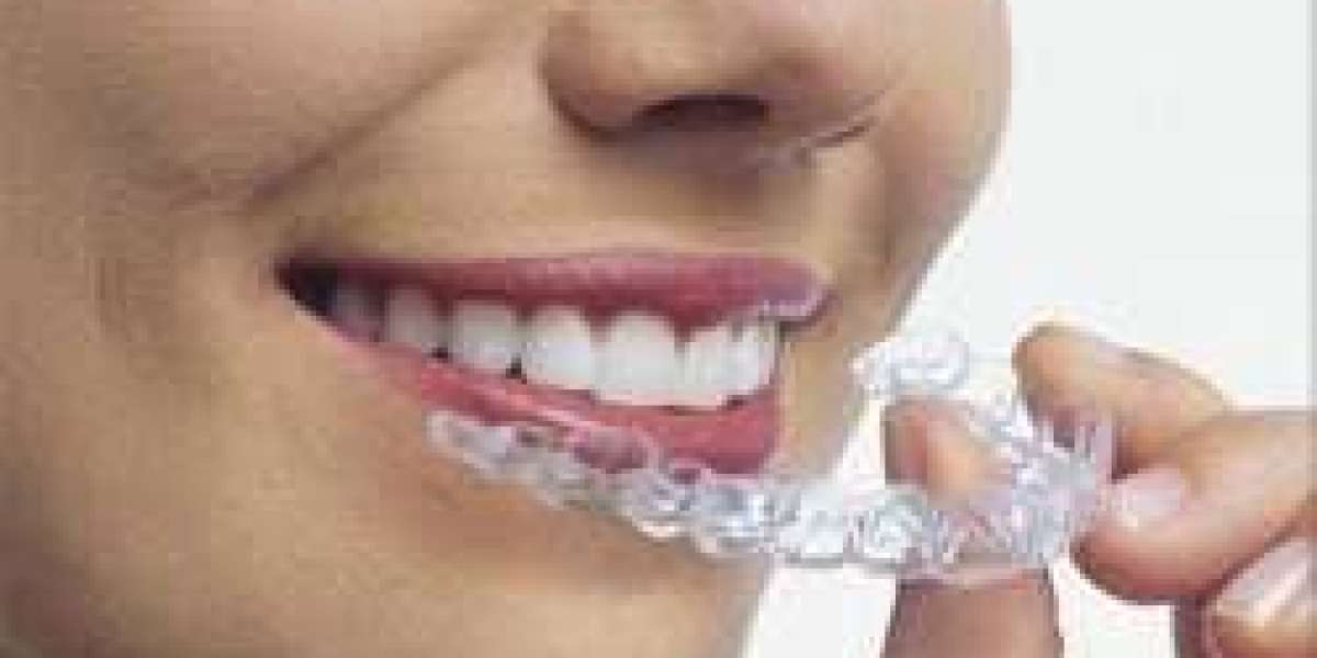 The Clear Path to a Confident and Modern Smile