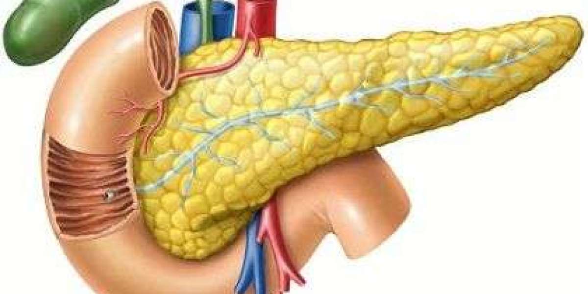 All About Pancreatic Cancer – Symptoms, Diagnosis & Treatment Options