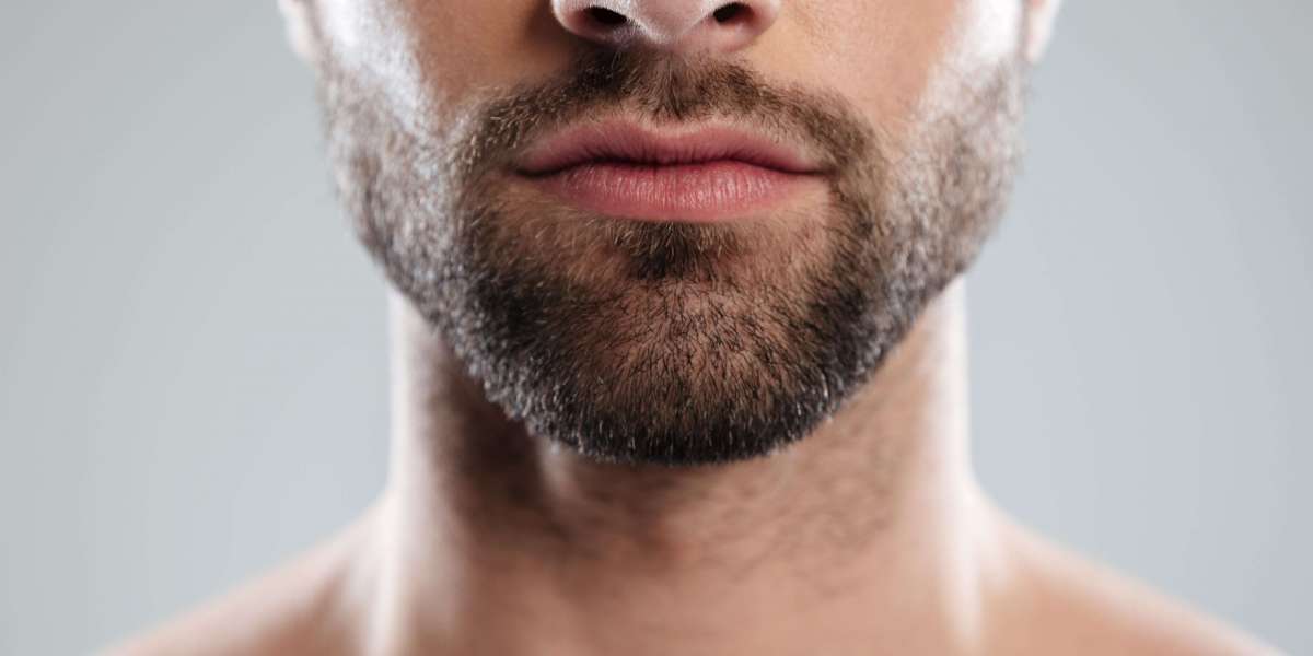 What is a Beard Transplant?