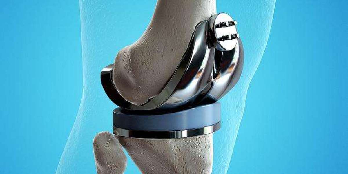 best hospital for knee replacement