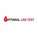 Optimal Lab Test