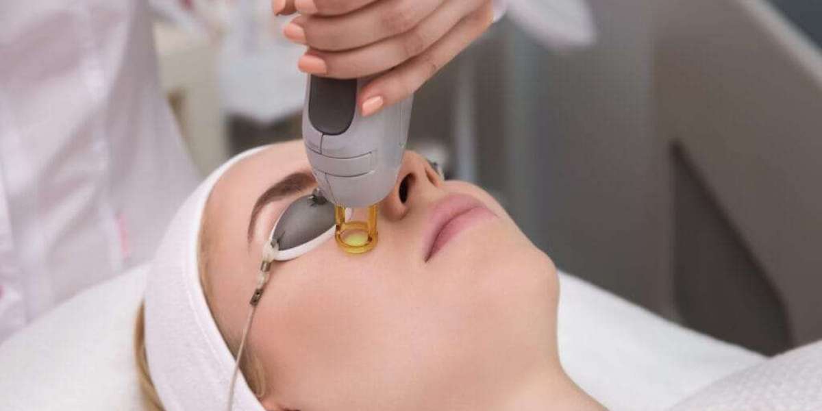 Fractional CO2 Laser Treatment for Hyperpigmentation