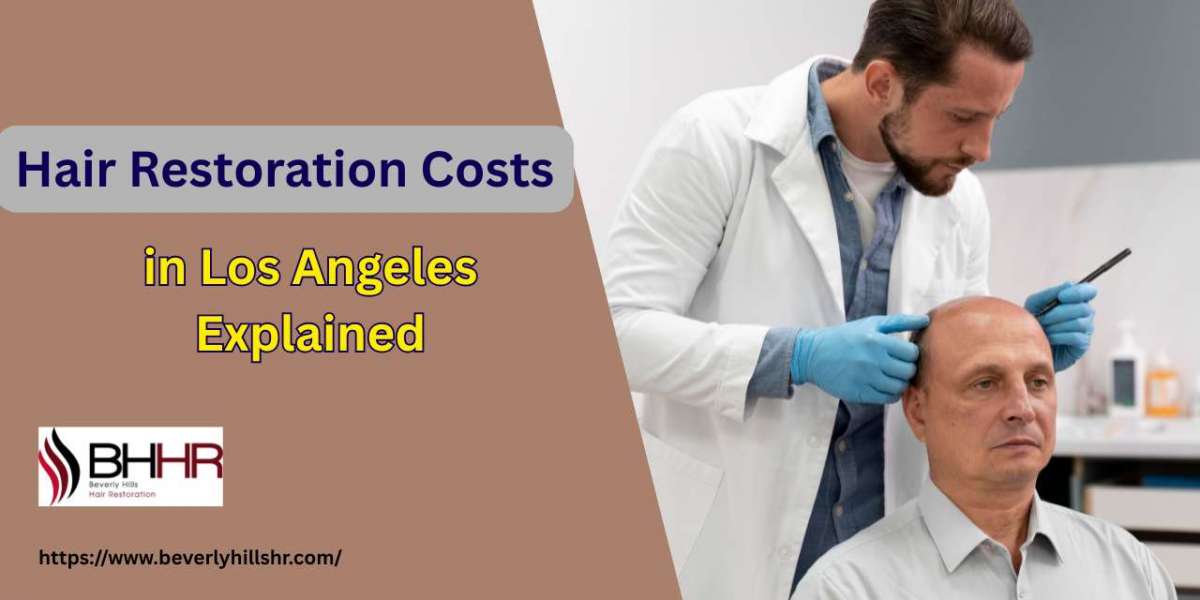 Hair Restoration Costs in Los Angeles Explained