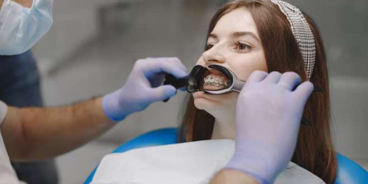 Smart Ways to Choose the Right Orthodontic Expert
