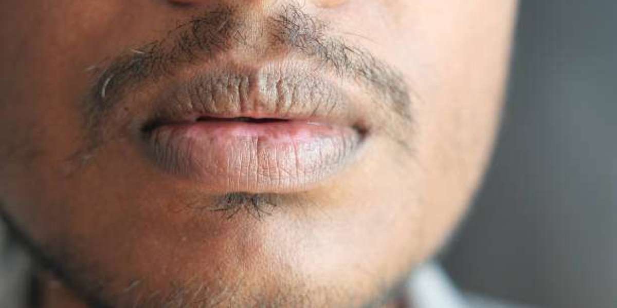 How Smoker’s Lips Treatment Supports Lip Rejuvenation