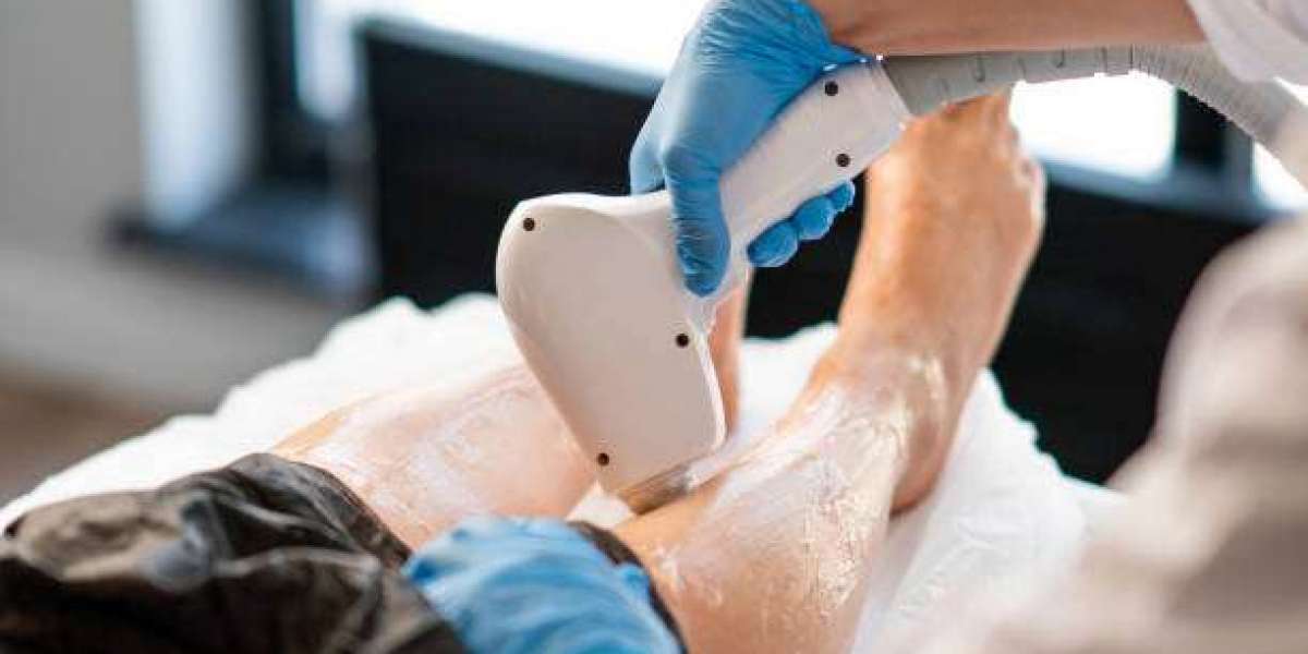 How Does Laser Hair Removal Compare to Threading?