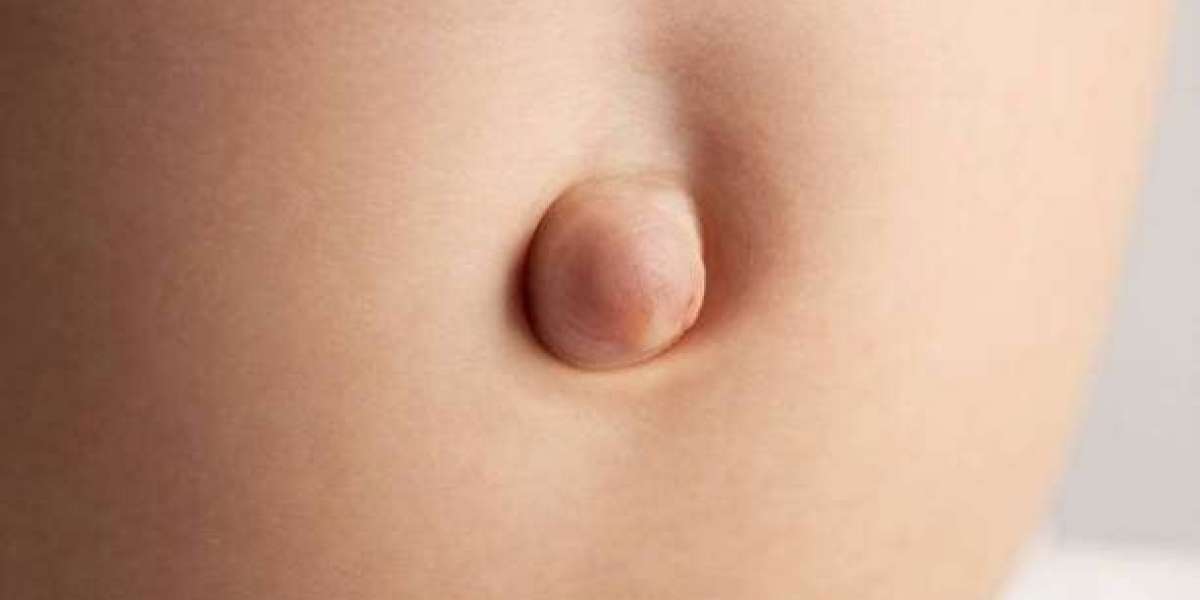Hernia Surgery Success Factors You Should Know