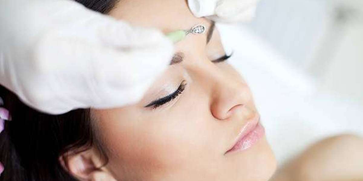Top Tips to Prepare for Electrolysis Hair Removal