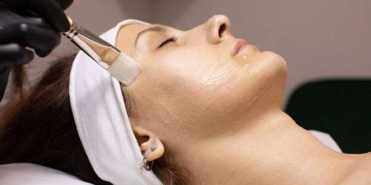 How to Extend the Benefits of Your Chemical Peel Treatment