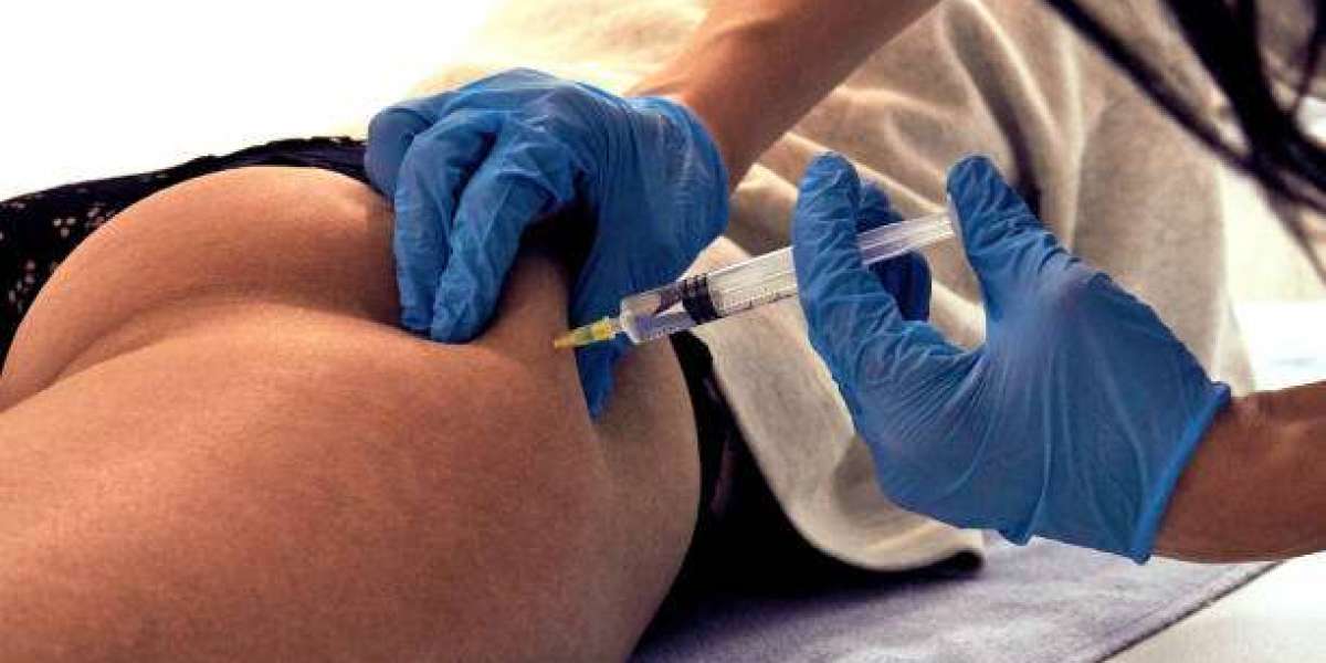Sculptra Injections vs Radiesse: Best for Deep Folds and Lines