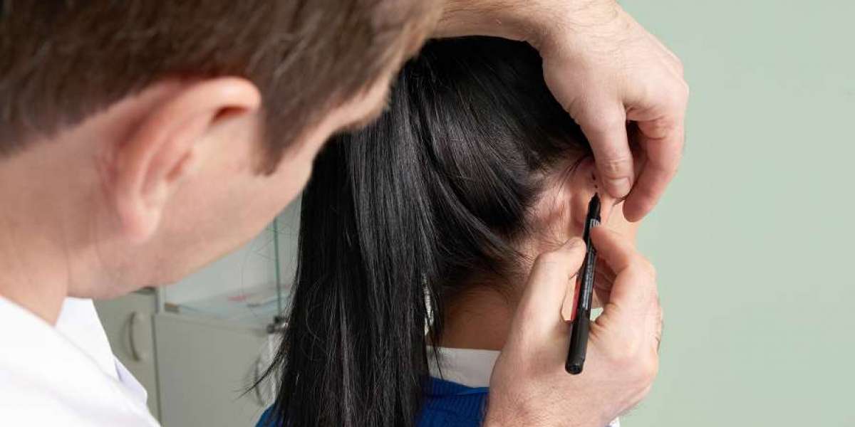 Dubai Ear Reshaping: Recovery, Costs, and Procedure Explained