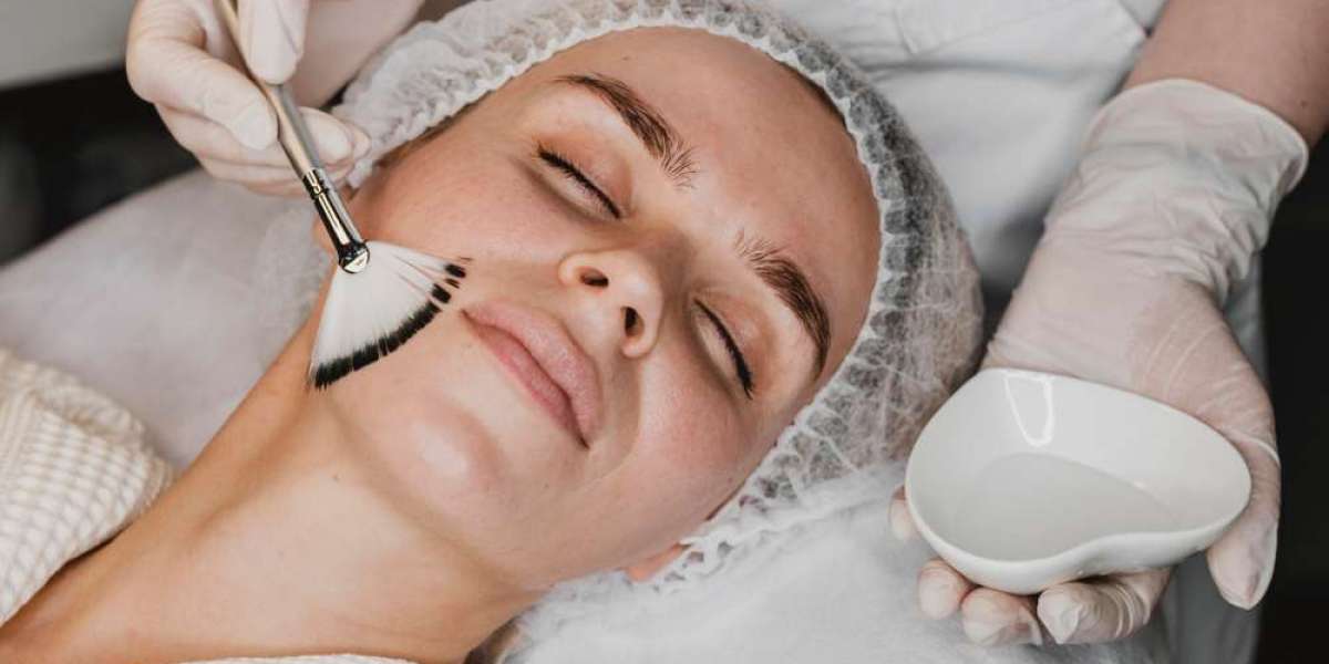 Radiesse in London: Restore Volume and Boost Collagen