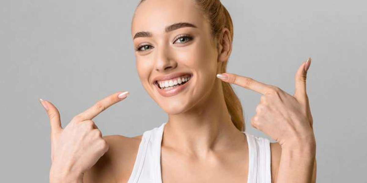 Hollywood Smile Makeover in Dubai for a Perfect Look
