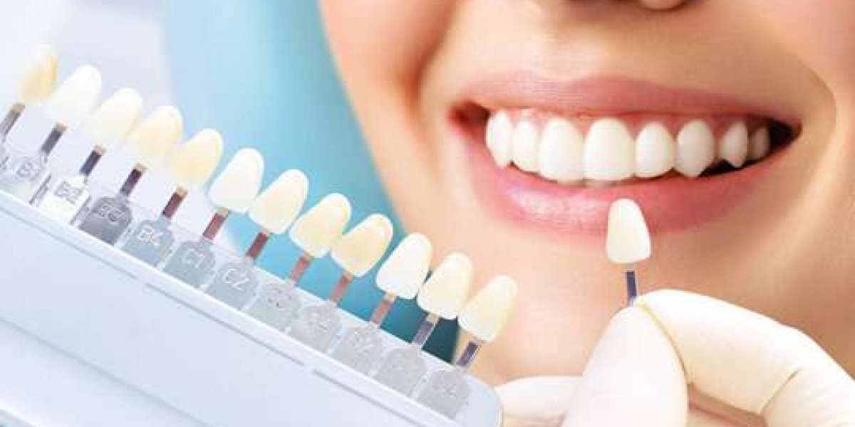 Why Cosmetic Dentists Are Better for Smile Corrections
