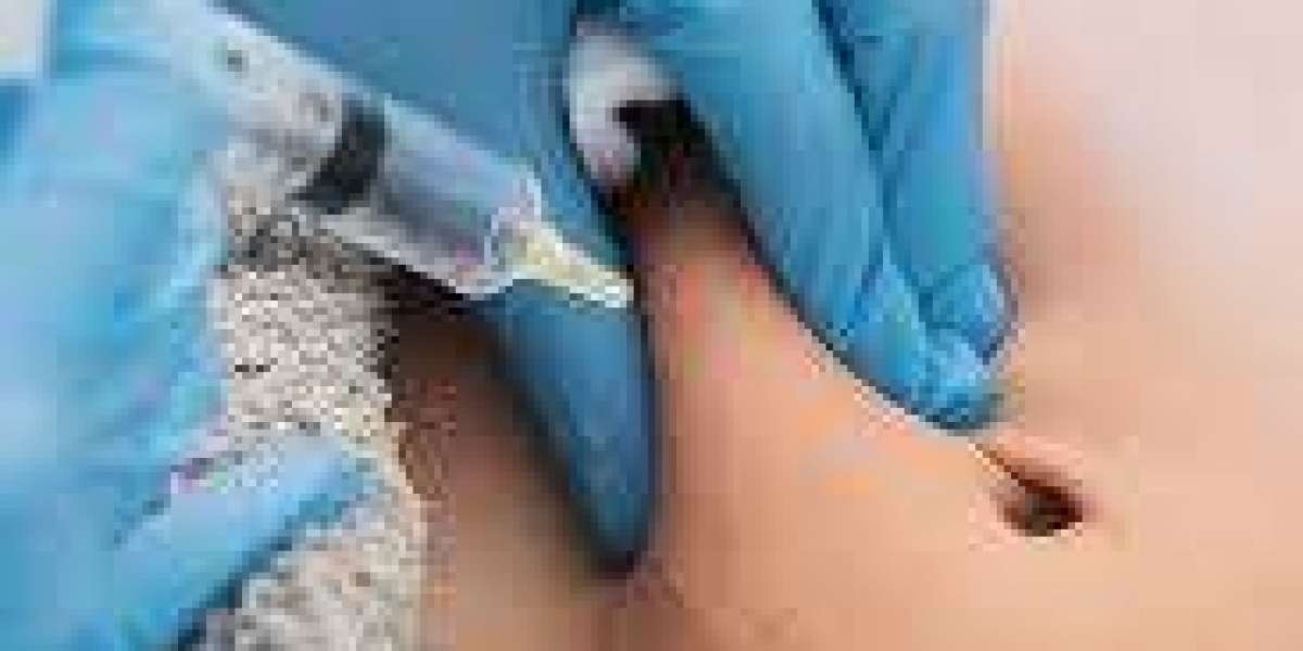 Can Fat Dissolving Injections in Dubai Treat Love Handles Effectively?