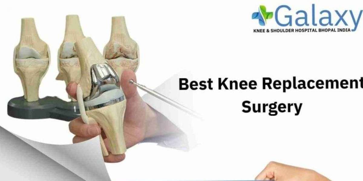 Best Knee Replacement Surgery in India | Dr. S.K. Gupta – Galaxy Hospital Bhopal