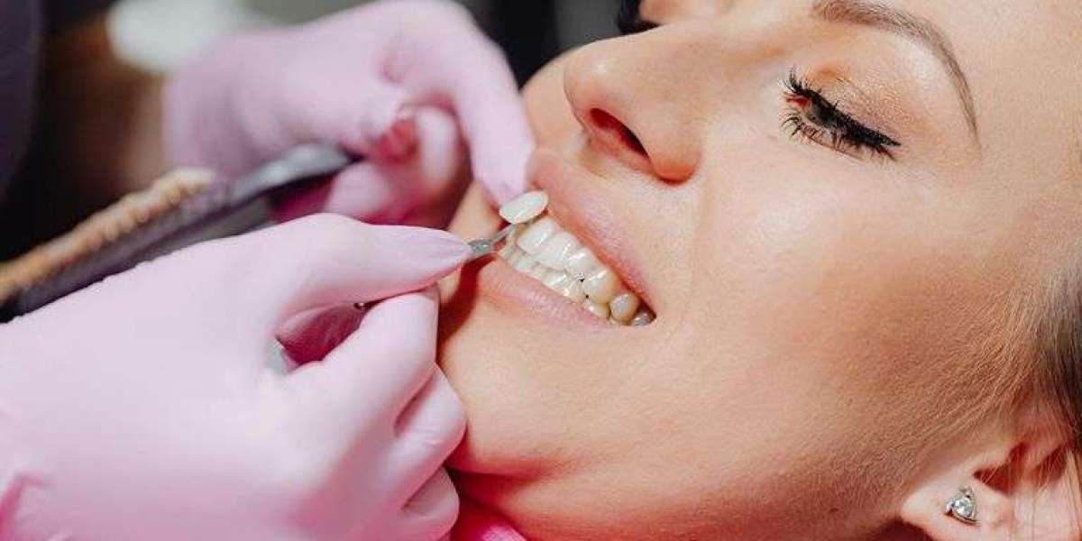 Cost-Effective Staffing Models for Small Dental Practices