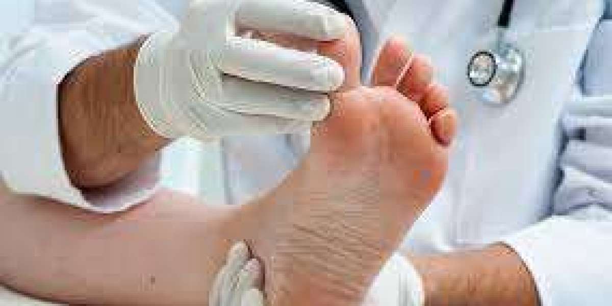 Diabetes Foot Care: Simple Steps to Protect Your Feet