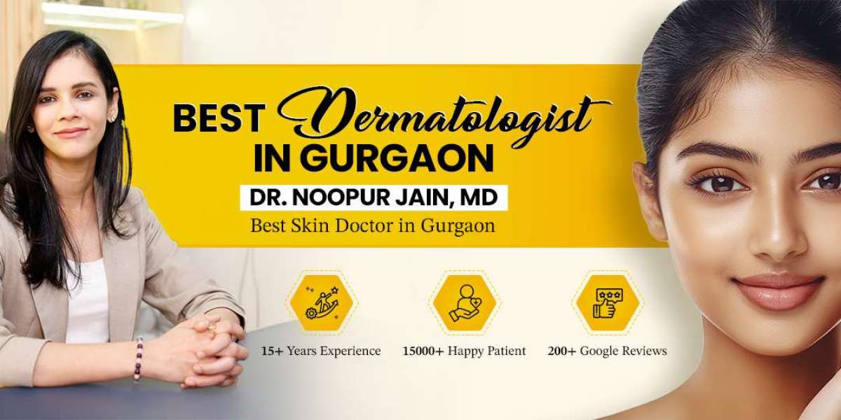 Melasma Treatment in Delhi | Dr. Noopur Jain – Skin Zest Clinic