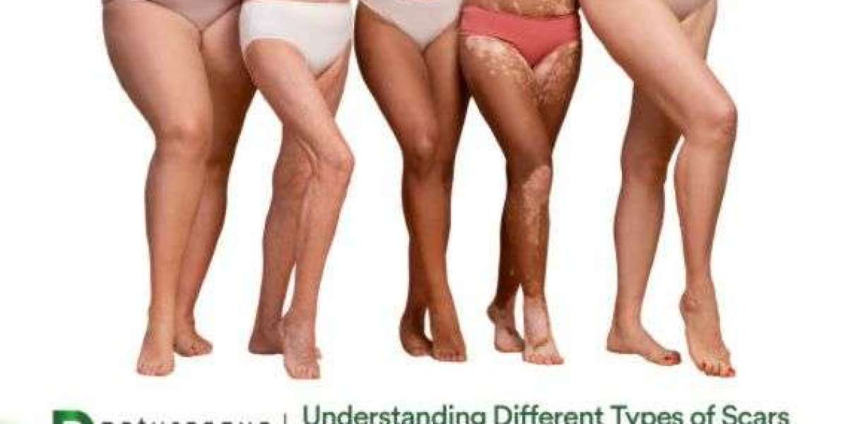 Understanding Different Types of Scars and Ayurvedic Remedies for Them