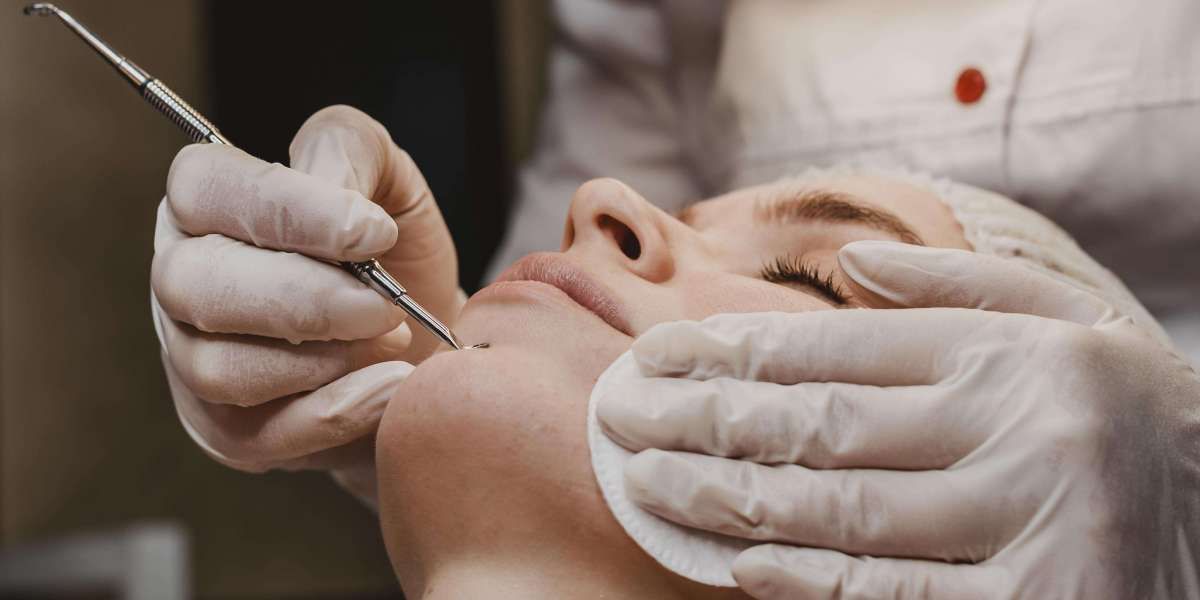 Q Swich Laser in Gurgaon | Dr. Ramanjit Singh – Dermcos Skin Care Clinic