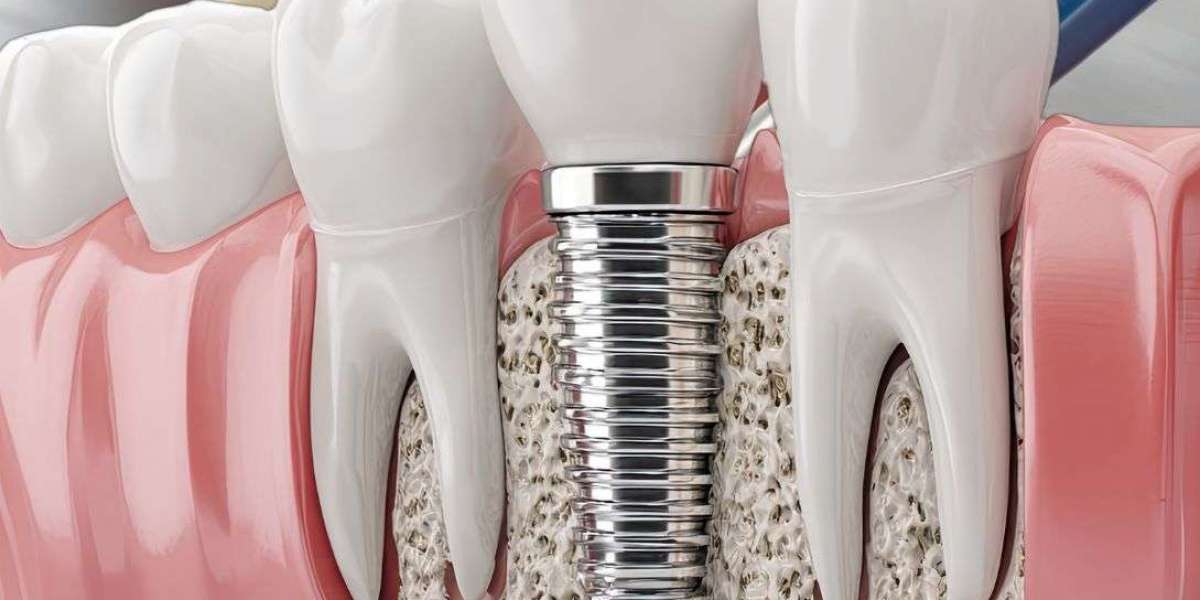 Restorative Dentistry Supporting Families With Simple and Effective Dental Care Options