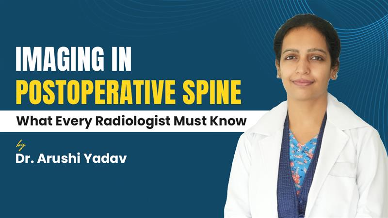 Imaging in Postoperative Spine: What Every Radiologist Must Know By Dr. Arushi Yadav 