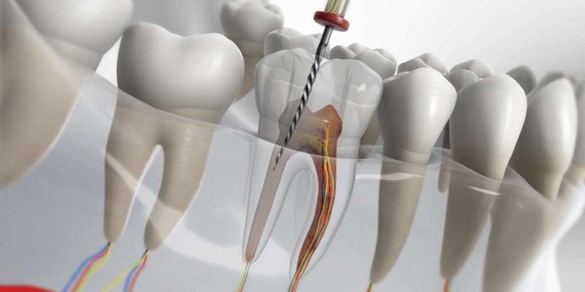 Modern Dental Care Solutions for Persistent Tooth Pain in the City of Tirupati