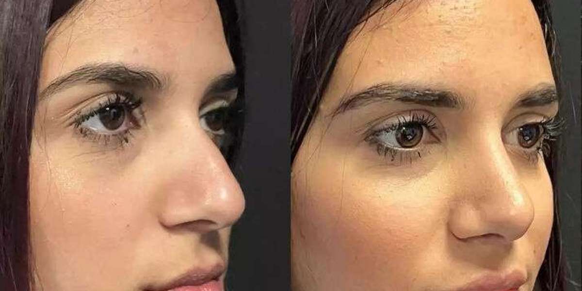 Best Doctors in Dubai for Comfortable Breathing Solutions