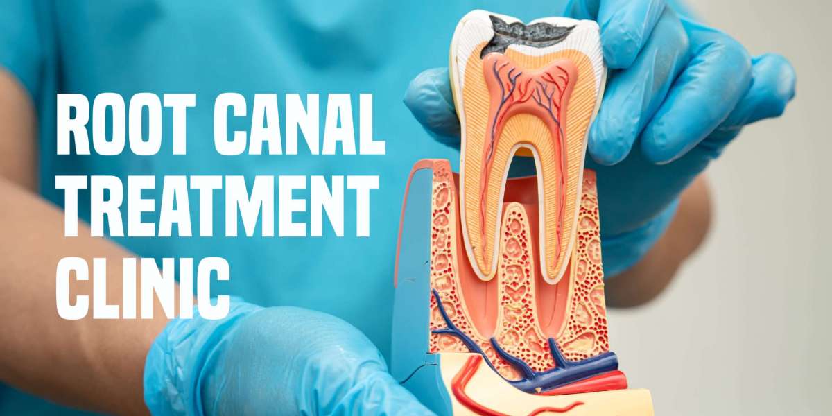 Smarter Smiles: Pune’s Best Dental Clinic for Hassle-Free Root Canal Treatments