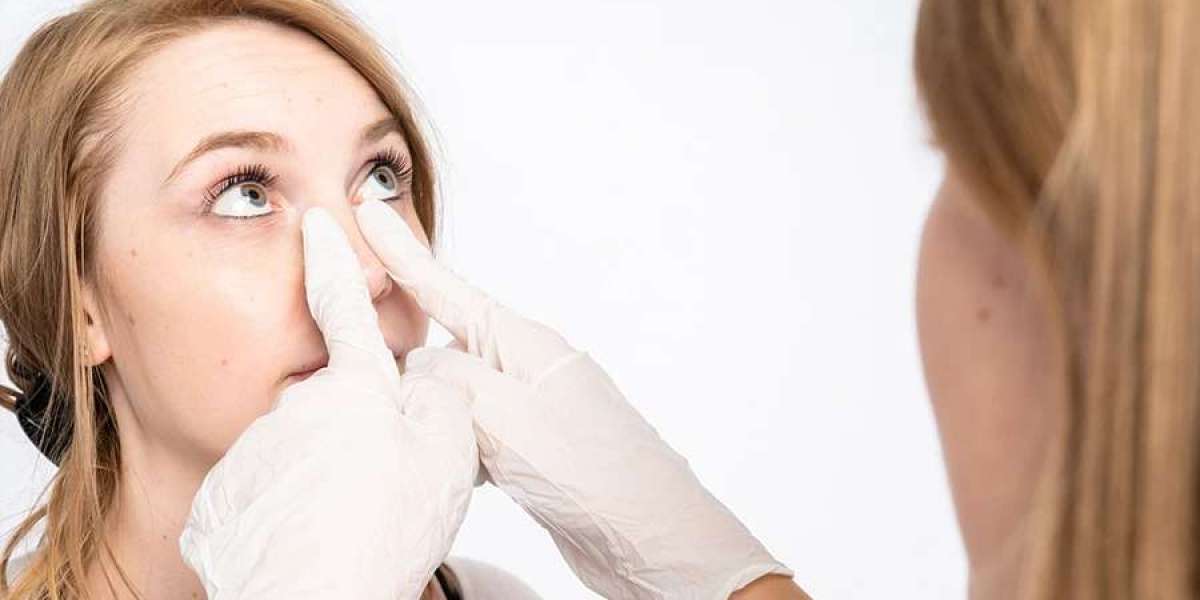 How Surgeons Measure Success in Rhinoplasty Outcomes