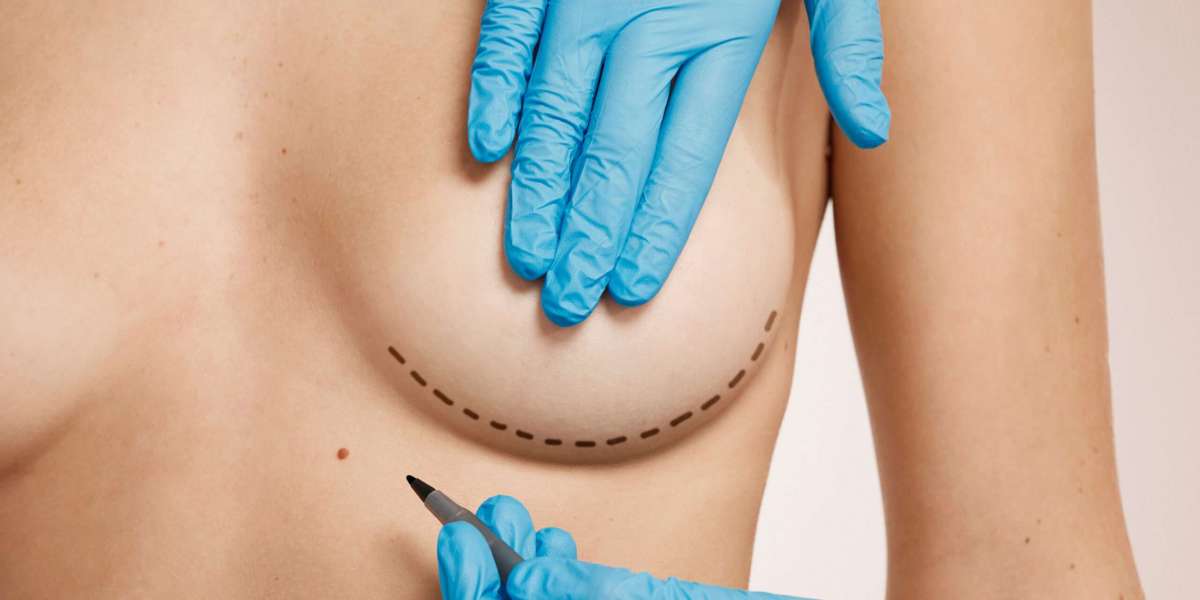 How Breast Surgery Can Improve Posture and Relieve Back Pain