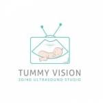 Tummy Vision