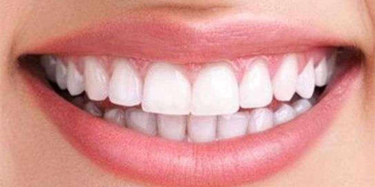 Italian Dental Clinic Dubai Offering Premium Dental Care