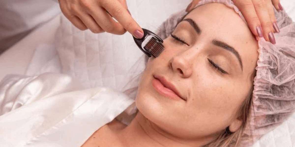 Can Dermatech Treat Scalp Conditions Like Dandruff?