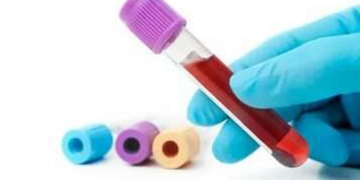 Candida Test vs. Other Fungal Tests: Key Differences