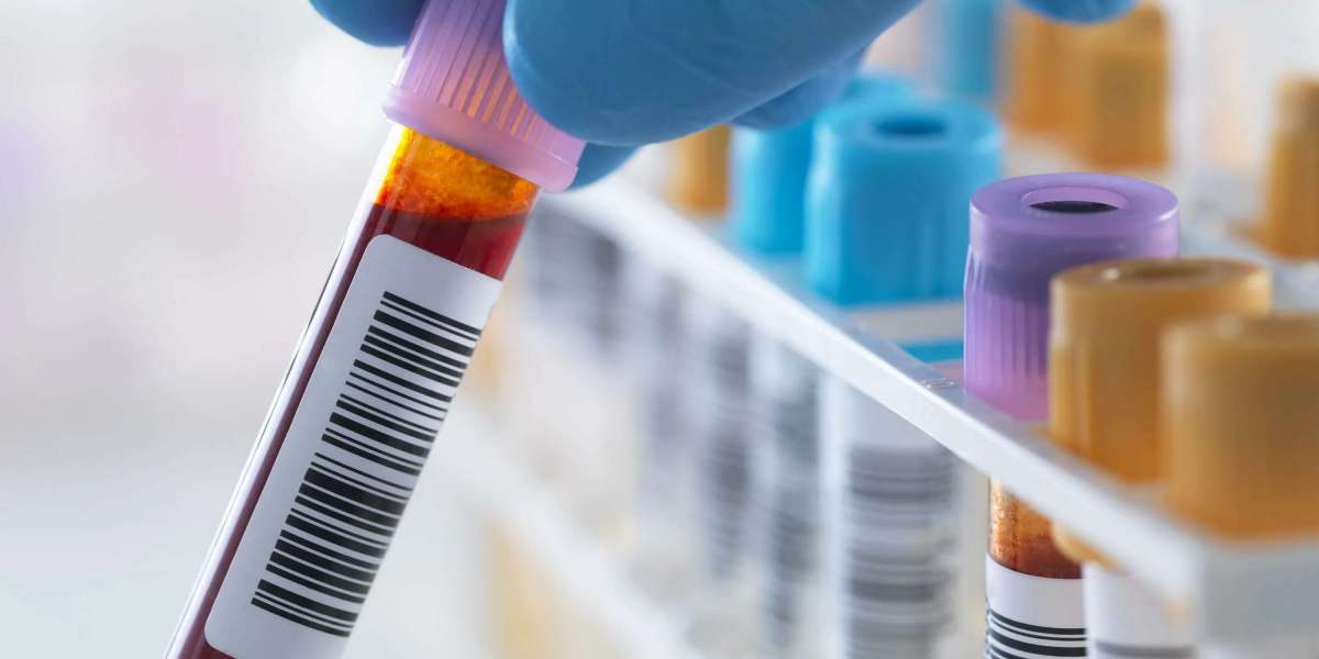 Is Syphilis Screening Painful? What First-Time Testers Should Know