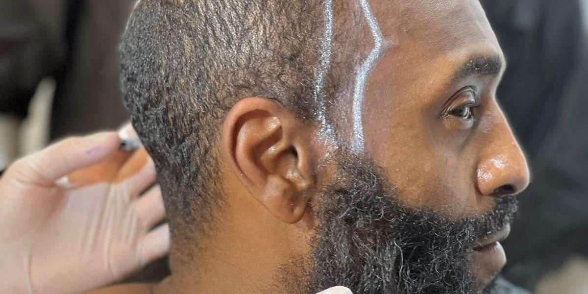 Is Hair Transplantation Painful?