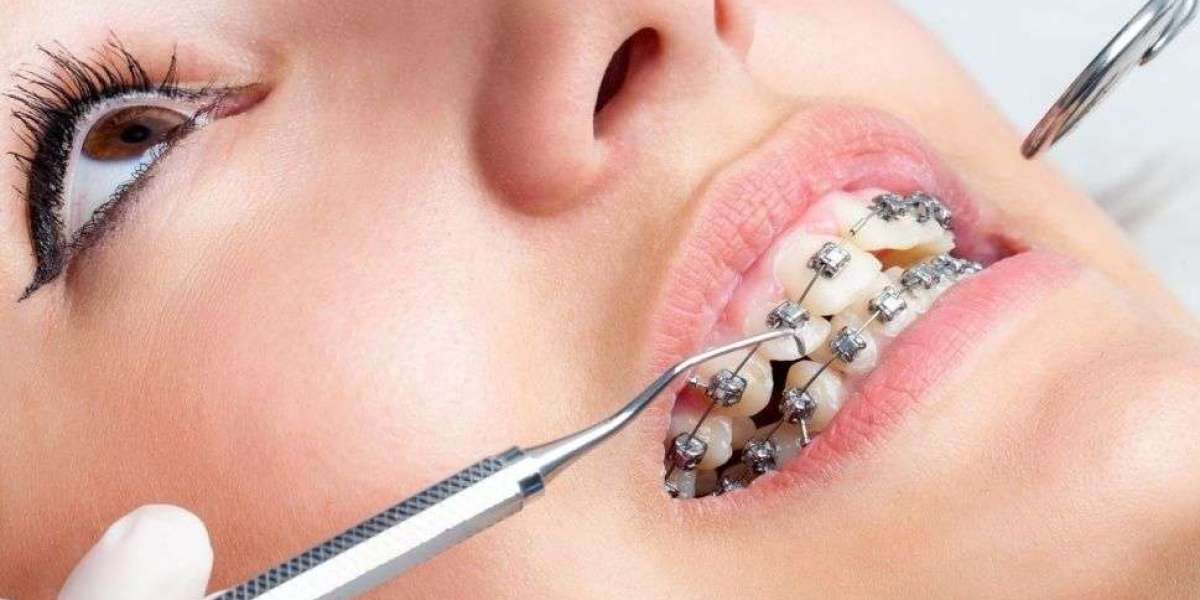 Dentistry on Mississauga Transforming Smiles with Cosmetic Dentistry