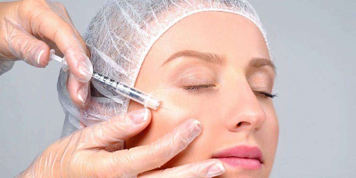 Can fillers improve the appearance of acne scars?